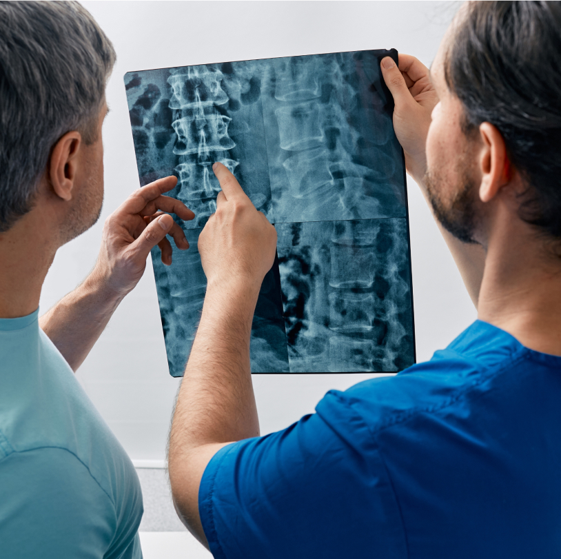 spinal cord injury xray
