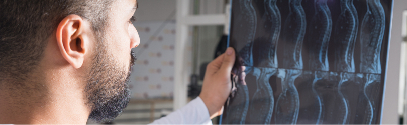 spinal cord injury xray